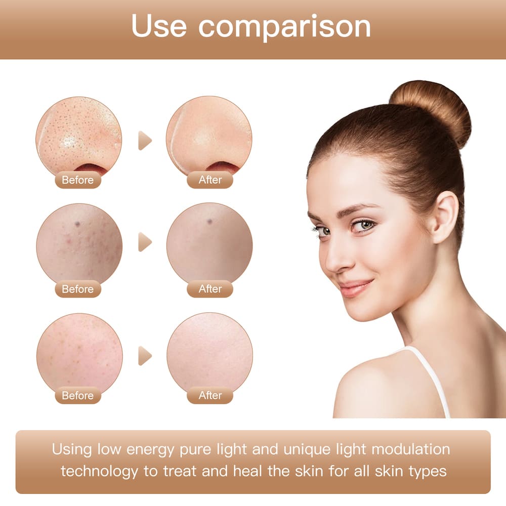 Beauty-Gesichtsmaske mit Photonentherapie gegen Falten für das Gesicht