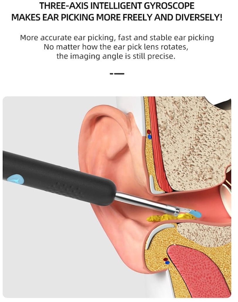 Ohrenschmalz-Entferner mit Kamera - Ohren reinigen