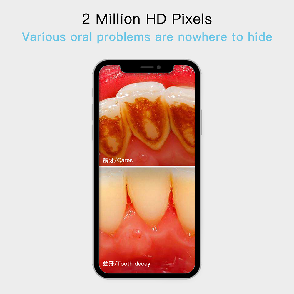 Zahnkamera Full HD Oral Dental Cam