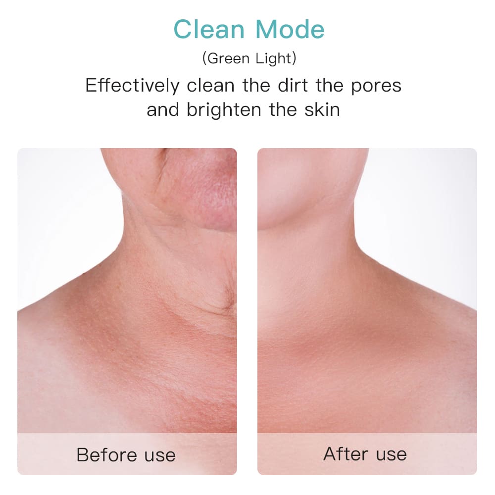 Effektiver Porenreiniger im Gesicht oder am Hals vorher nachher