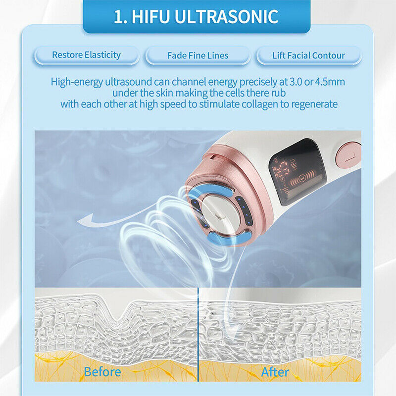 Hifu-Ultraschall